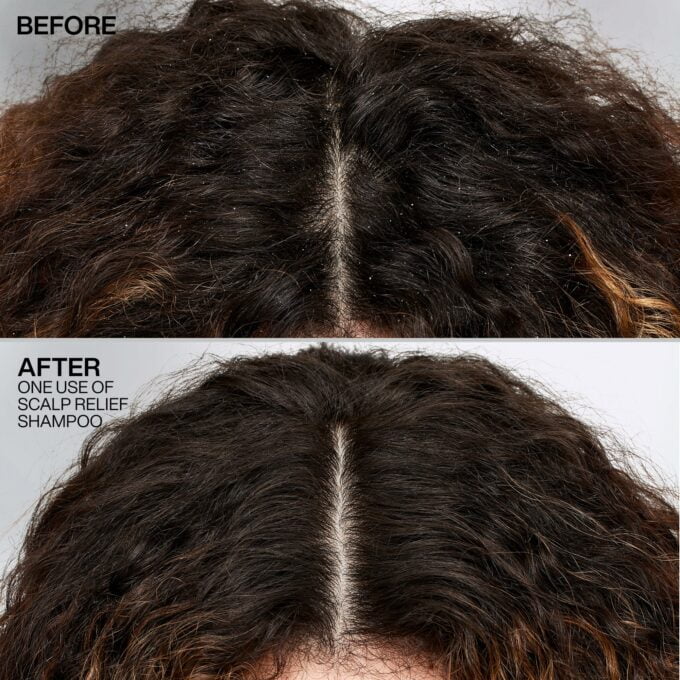 Redken Scalp Relief Dandruff Control Shampoo 250ml Halo Hair & Skin - khdskinhairbeautyau.com
